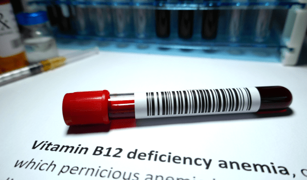 vitamin B12 deficiency