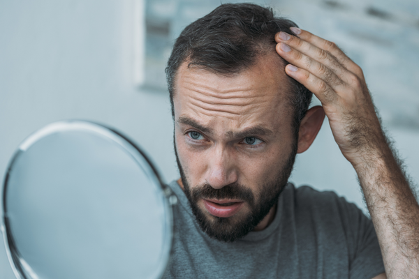 Man checking for hair loss