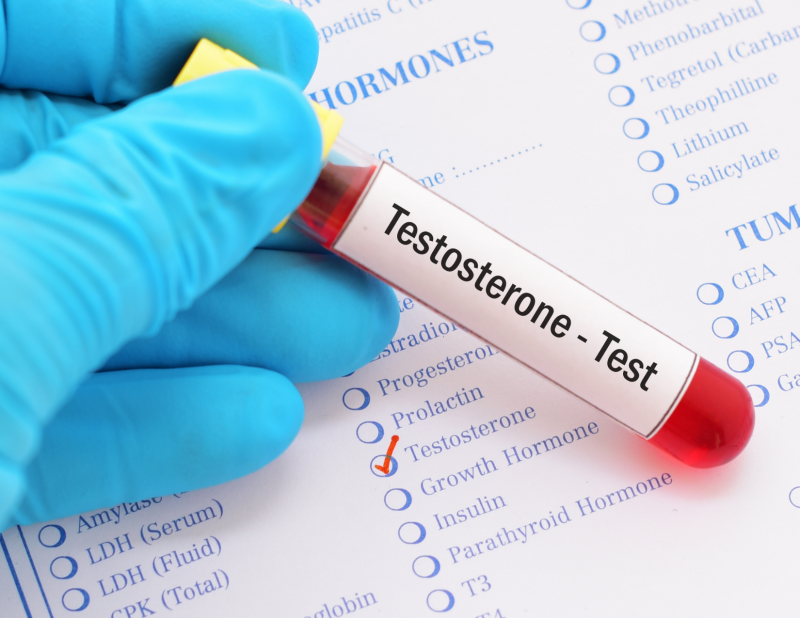 free testosterone