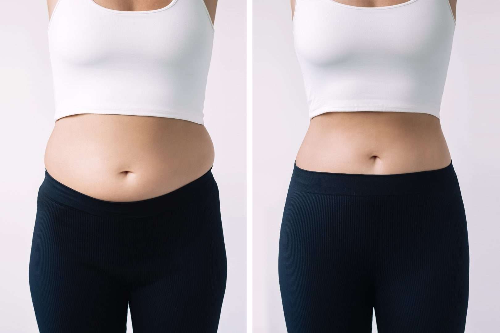 Before and after of a woman losing weight